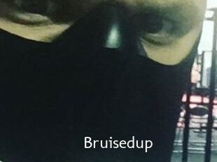 Bruisedup