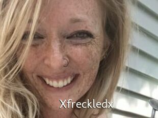 Xfreckledx